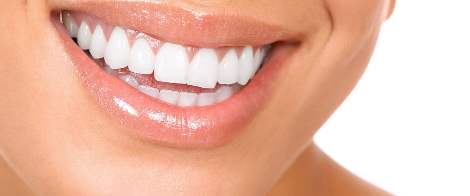 Aesthetic Dentistry What is it and What are the Benefits?