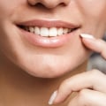 What are the examples of cosmetic dentistry?