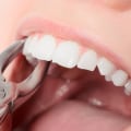 Is a cosmetic dentist the same as a dentist?