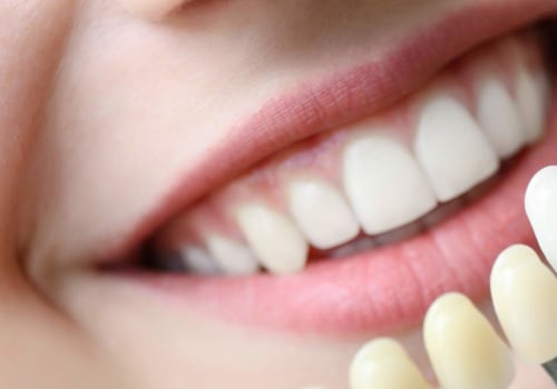Why do people get cosmetic dentistry?