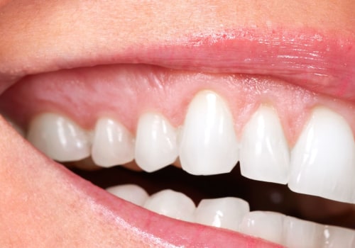 Do Cosmetic Dentists Buy Insurance?