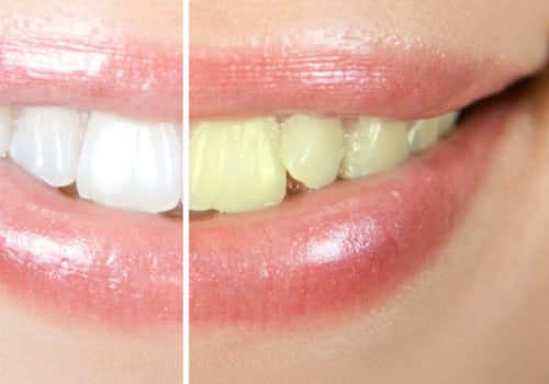 What are the benefits of aesthetic dentistry?