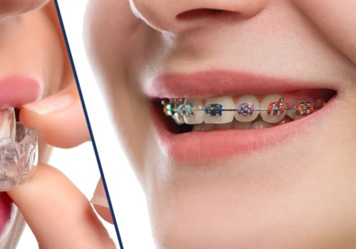 What is the difference between cosmetics and braces?