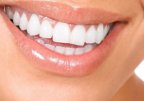 Aesthetic Dentistry: What is it and What are the Benefits?