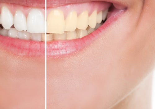 What is the cosmetic dentist?