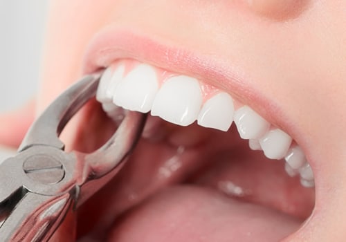 The Difference Between a Cosmetic Dentist and a General Dentist