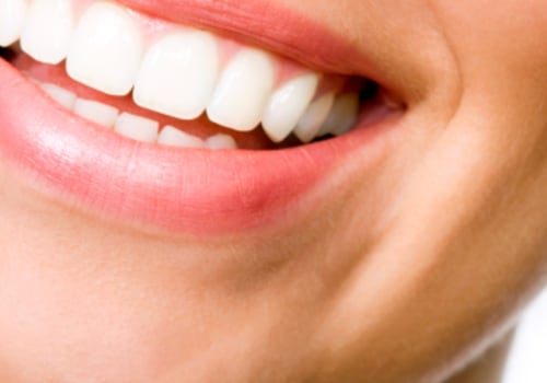 How to Find the Perfect Cosmetic Dentist